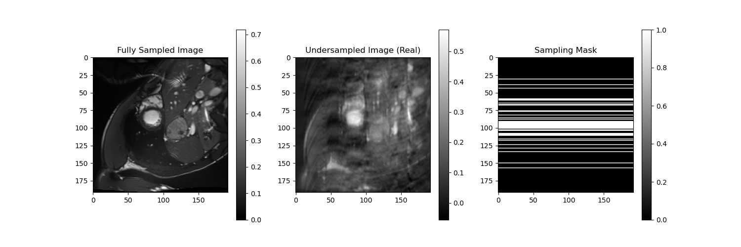 Undersampling Patterns Frame 0