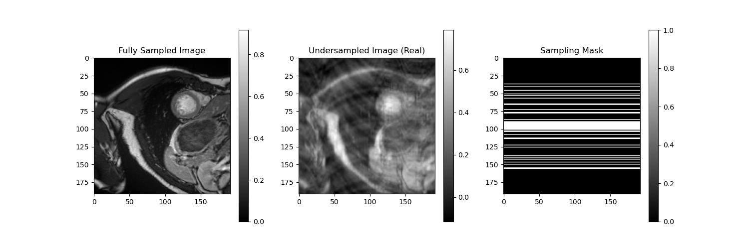 Undersampling Patterns Frame 1