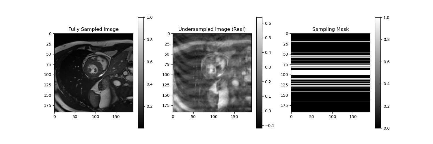Undersampling Patterns Frame 2