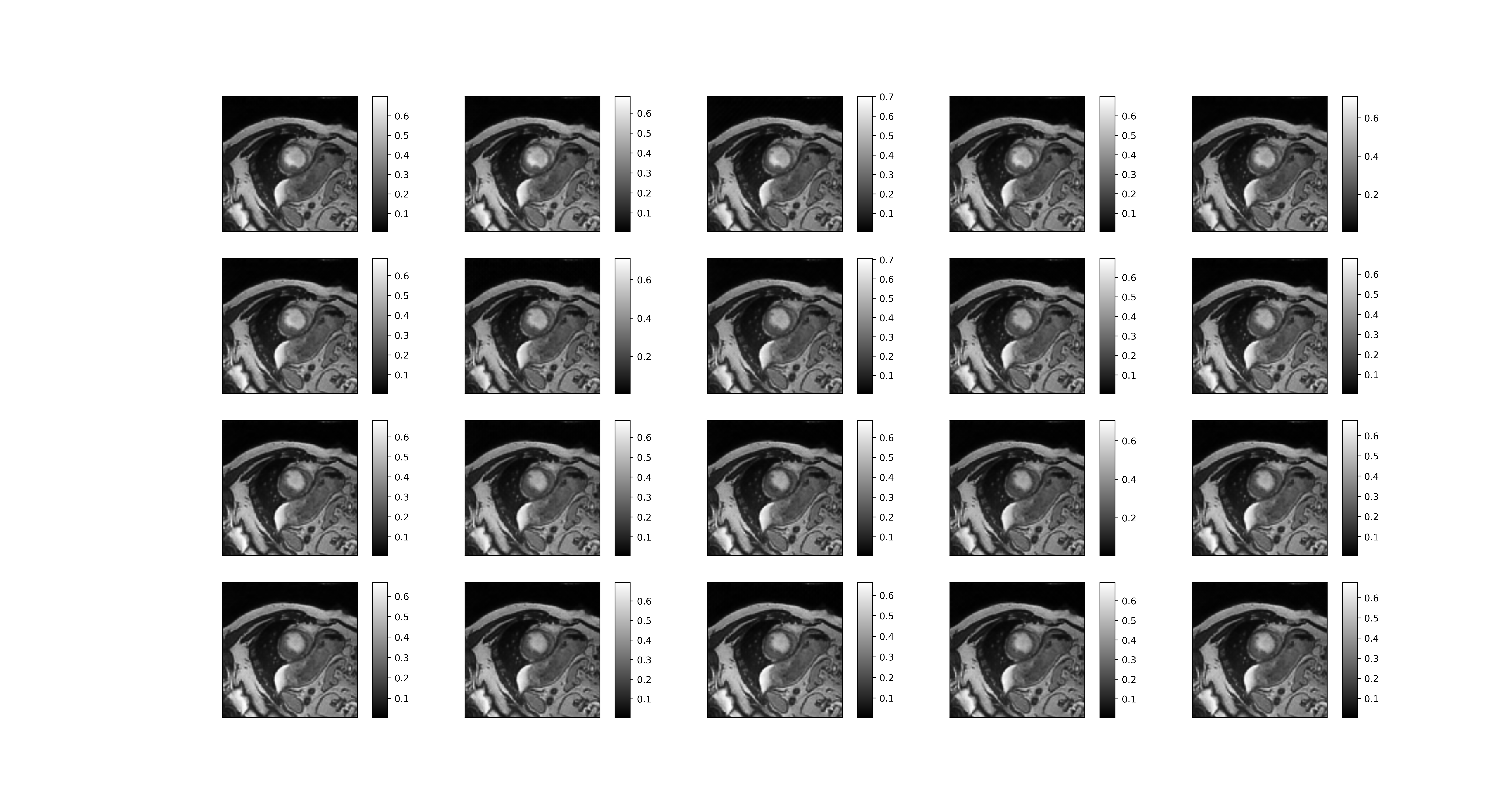 Reconstructed Image1